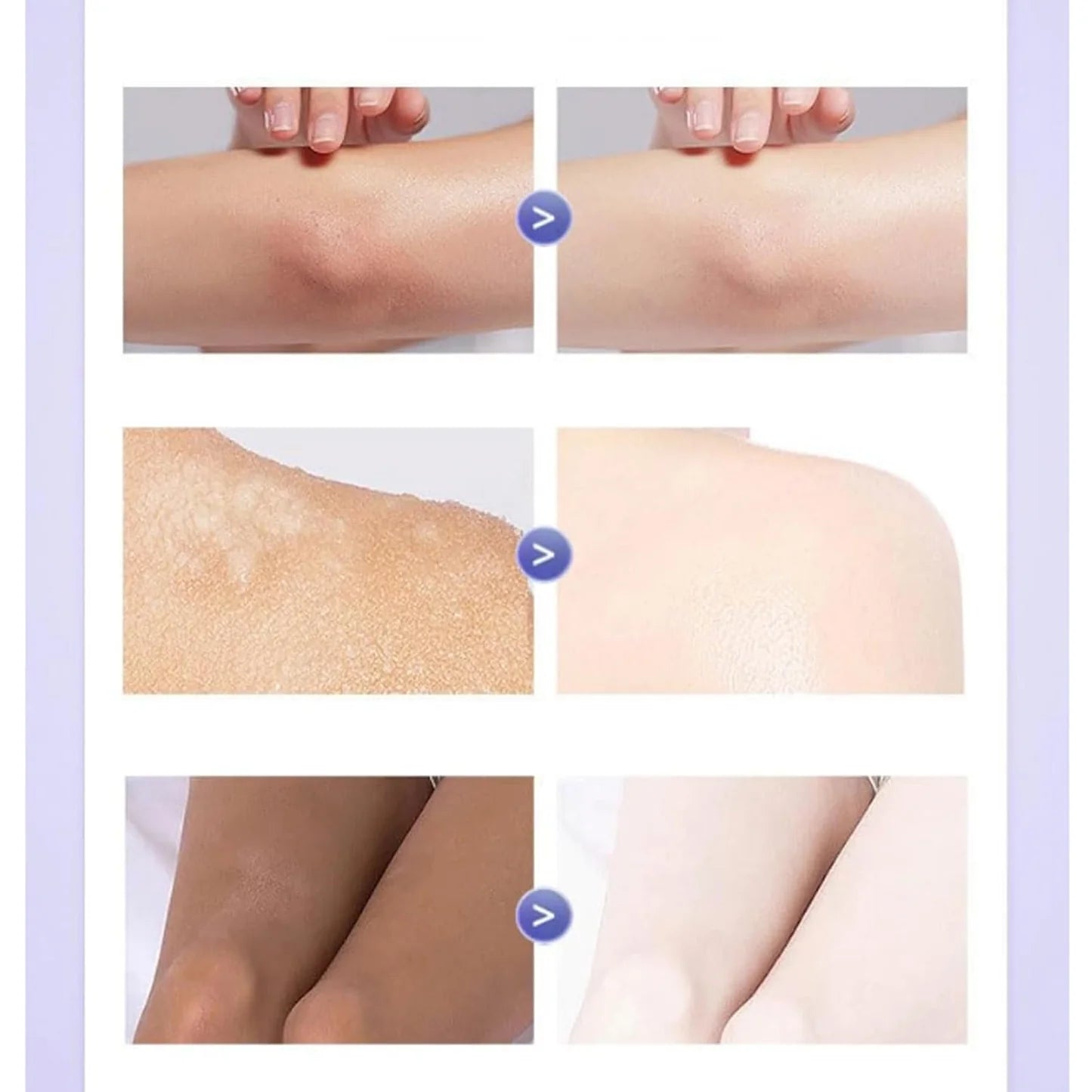 Omenfee Cold White Skin All Over | (Both for Men & Women)